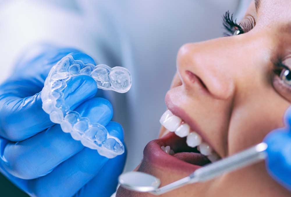 Can Invisalign Be Covered by NHS?