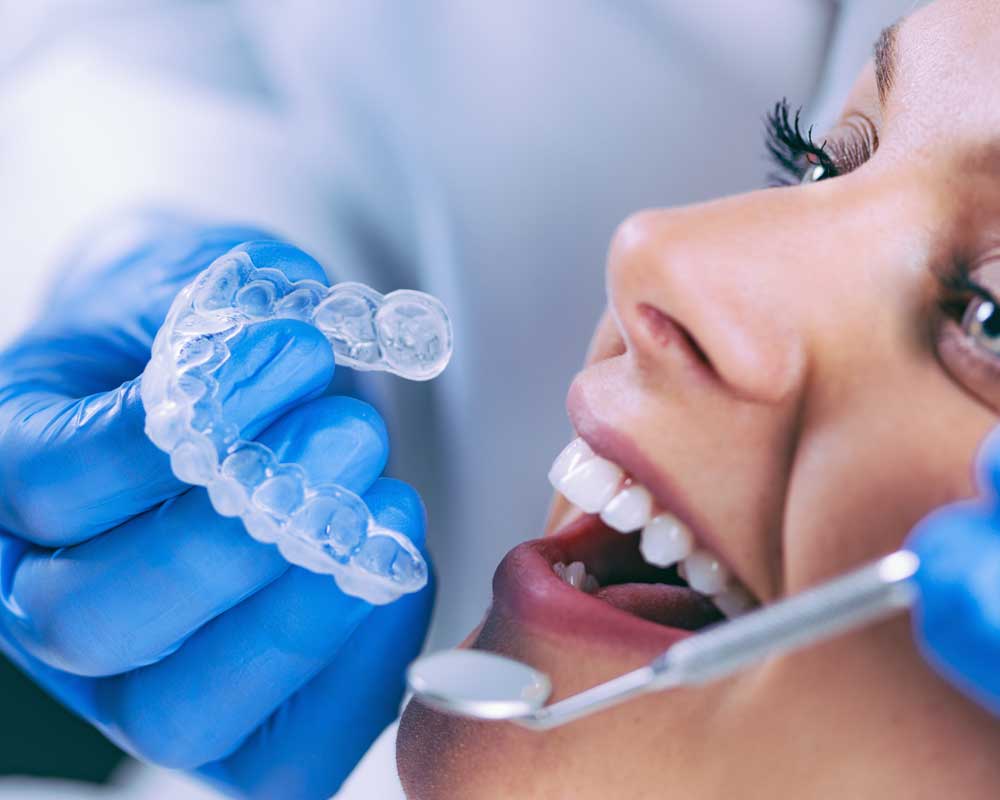 Can Invisalign Be Covered by NHS?