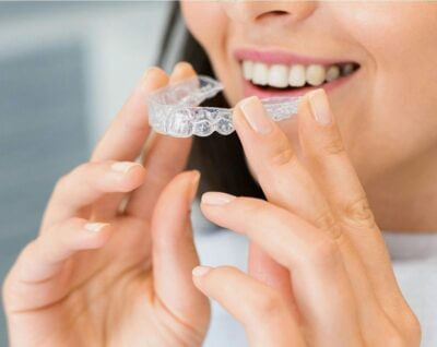 What to Consider Before Choosing Invisalign