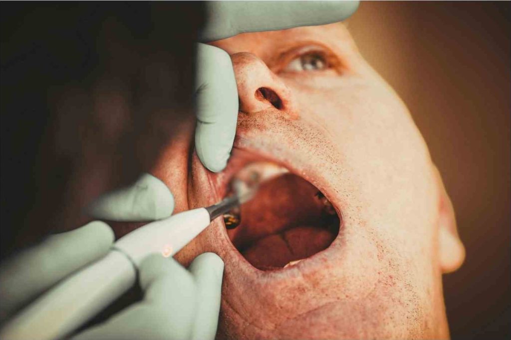Dental operation
