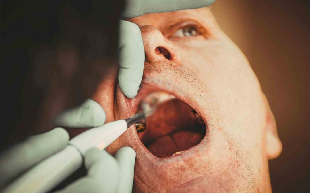 Can My Body Reject A Dental Implant?