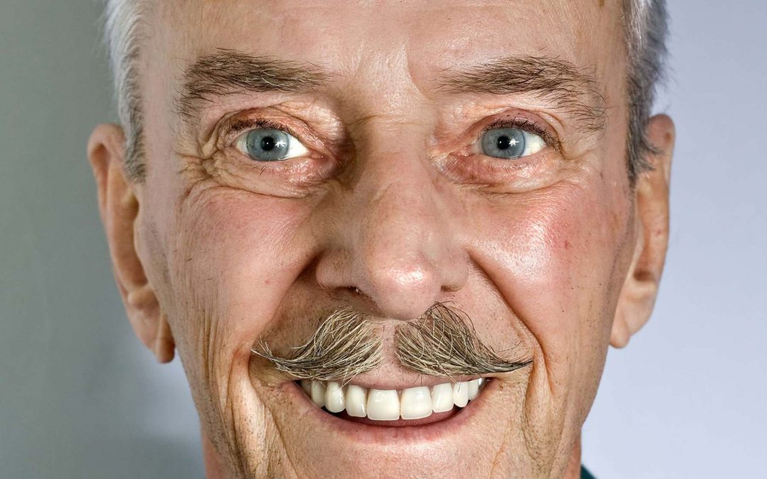 Do Dental Implants Last Forever?