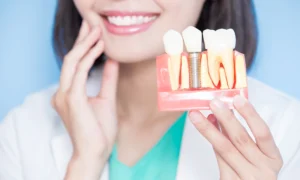 Dental Implants vs Dentures: Which Is Right for Me in 2026