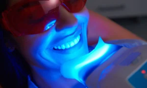 Teeth Whitening in Canterbury: What Works, What Doesn’t, What to Avoid